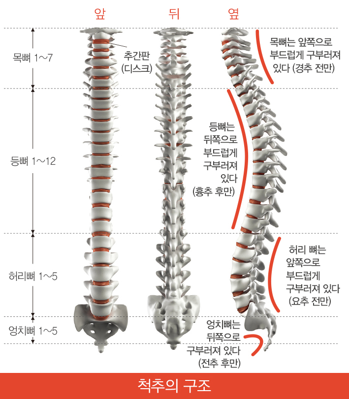 디스크(2) 추간판 탈출증