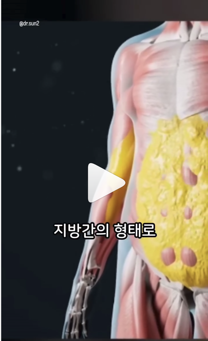 최악만 피해서 먹자(염증은 어떻게 우리 몸을 망칠까)