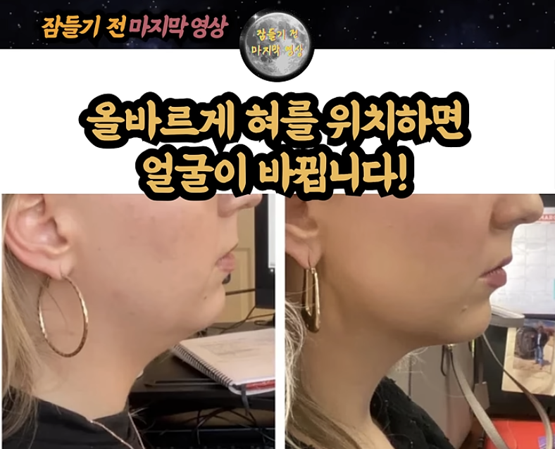 당신의 혀는 어디에 위치하고 있나요 (feat. 거북목) | TIL #3